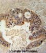 Dual Specificity Tyrosine Phosphorylation Regulated Kinase 1A (DYRK1A) Antibody