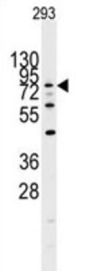 Dual Specificity Tyrosine Phosphorylation Regulated Kinase 1A (DYRK1A) Antibody
