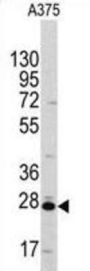 CLIC1 Antibody