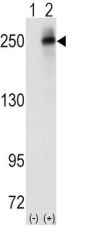 ALK Tyrosine Kinase Receptor (ALK) Antibody