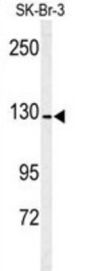 Aminopeptidase N (ANPEP) Antibody