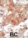 EPH Receptor A4 (EphA4) Antibody