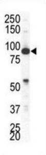 EPH Receptor A4 (EphA4) Antibody