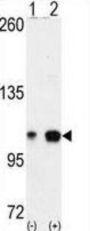 EPH Receptor A4 (EphA4) Antibody