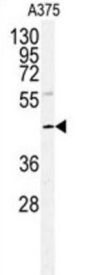 POLDIP2 Antibody
