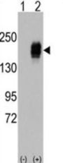 Epidermal Growth Factor Receptor (EGFR) Antibody