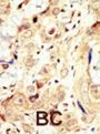 Receptor Tyrosine-Protein Kinase ErbB-4 (ERBB4) Antibody