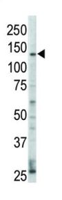 Receptor Tyrosine-Protein Kinase ErbB-4 (ERBB4) Antibody