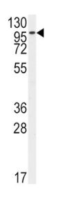 FGFR2 Antibody