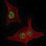Fibroblast Growth Factor Receptor 4 (FGFR4) Antibody