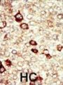 Fibroblast Growth Factor Receptor 4 (FGFR4) Antibody