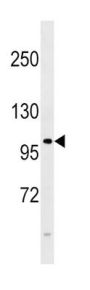 Fibroblast Growth Factor Receptor 4 (FGFR4) Antibody