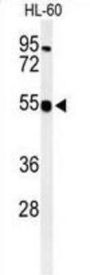 Heparan Sulfate 2-O-Sulfotransferase 1 (HS2ST1) Antibody