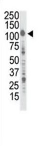 Insulin Receptor R Antibody