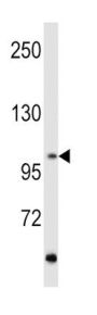 Retinol (RET) Antibody