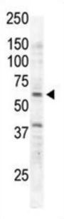 Tyrosine-Protein Kinase RYK (RYK) Antibody