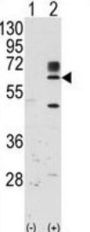 Tyrosine-Protein Kinase RYK (RYK) Antibody