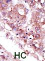 STK33 Antibody