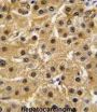 Tyrosine-Protein Kinase ABL1 (ABL1) Antibody