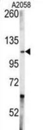 Tyrosine-Protein Kinase ABL1 (ABL1) Antibody