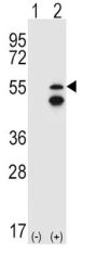 Fyn Related Kinase (FRK) Antibody