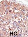 Protein Tyrosine Kinase 6 (PTK6) Antibody