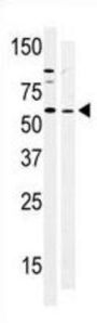 Protein Tyrosine Kinase 6 (PTK6) Antibody