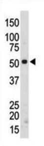 Tyrosine-Protein Kinase Srms (SRMS) Antibody
