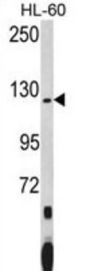 PUM1 Antibody