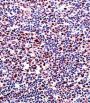 Runt-Related Transcription Factor 2 (RUNX2) Antibody