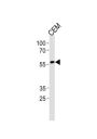 Runt-Related Transcription Factor 2 (RUNX2) Antibody