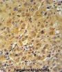 FK506 Binding Protein 1A (FKBP1A) Antibody