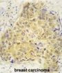 Semaphorin 3A (SEMA3A) Antibody