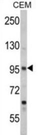 Semaphorin 3A (SEMA3A) Antibody