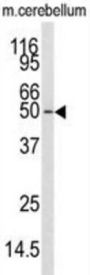 Calcium/Calmodulin Dependent Protein Kinase Kinase 1 (CAMKK1) Antibody