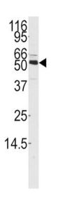 Calcium/Calmodulin Dependent Protein Kinase Kinase 1 (CAMKK1) Antibody