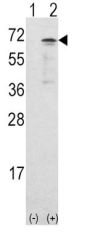 Calcium/Calmodulin Dependent Protein Kinase Kinase 1 (CAMKK1) Antibody