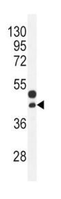 Connective Tissue Growth Factor (CCN2) Antibody