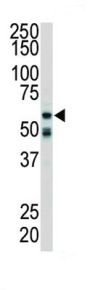 Receptor Interacting Serine Threonine Kinase 2 (RIPK2) Antibody