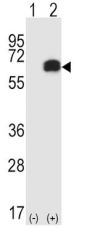Receptor Interacting Serine Threonine Kinase 2 (RIPK2) Antibody