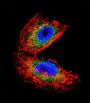 Acetylcholinesterase (AChE) Antibody
