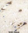 Acetylcholinesterase (AChE) Antibody