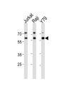 Acetylcholinesterase (AChE) Antibody