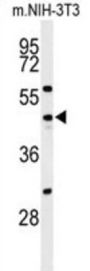 Cell Division Cycle 25C (CDC25C) Antibody