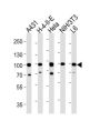 Heat Shock Protein 90kDa Alpha B1 (HSP90AB1) Antibody