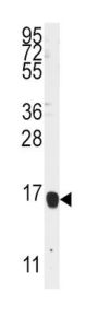 Arachidonate 5-Lipoxygenase-Activating Protein (ALOX5AP) Antibody