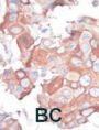 MAPK/ERK Kinase Kinase 1 (MEKK1) Antibody