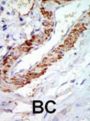 Proto-Oncogene C-Cot (COT) Antibody