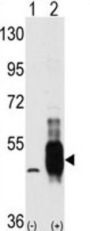 Proto-Oncogene C-Cot (COT) Antibody