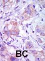 MLK1 Antibody